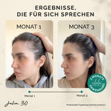 Rosemary Hair Boost